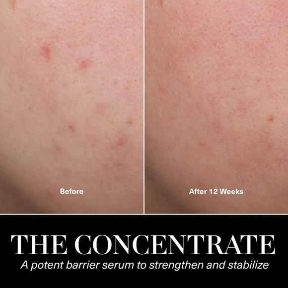 LaMer The Concentrate Face Serum 0.5oz / 15ml - Picture 6 of 10